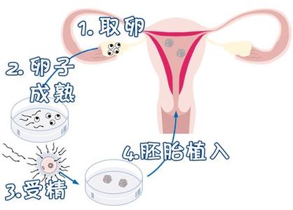 张蓝之主任